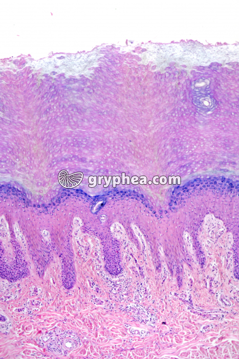 Peau plante du pied CT x25 - gryphea.org